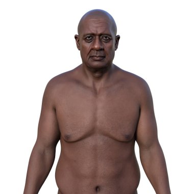 Üst düzey bir Afrikalı adamın üst yarısını gösteren 3 boyutlu fotorealistik bir resim derisinin, yüzünün ve vücut anatomisinin karmaşık detaylarını gözler önüne seriyor..