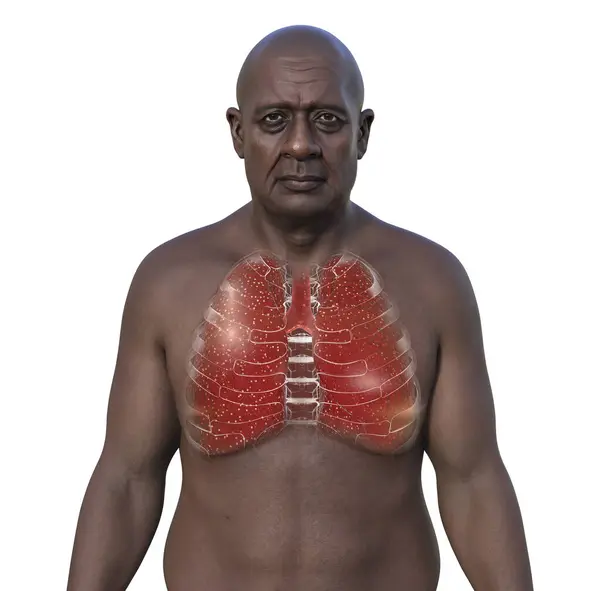 Fotorealistisk Illustration Porträttera Afrikansk Man Med Transparent Hud Visa Upp — Stockfoto