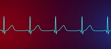 Geniş tabanlı T-dalgalarıyla uzun QT aralığı gösteren bir elektrokardiyogramın (ECG) 3 boyutlu çizimi, tip 1 uzun QT sendromunun karakteristiği.