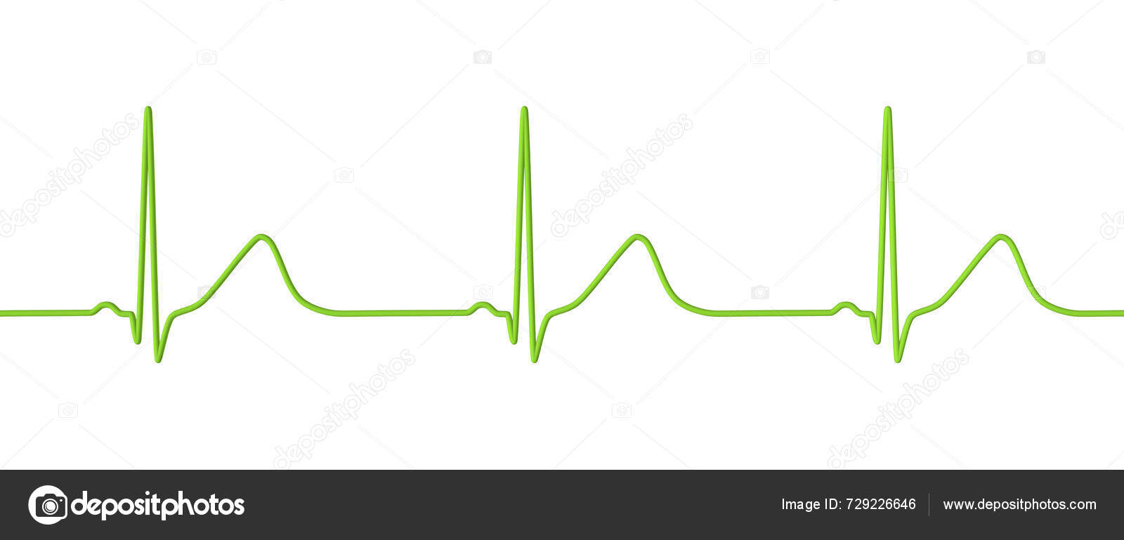 Ilustraci n electrocardiograma ecg que muestra intervalo prolongado con