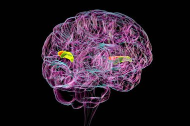 3D illustration of a human brain with the transverse temporal gyri highlighted, anterior in green and posterior in orange. These regions are involved in auditory processing and language comprehension. clipart