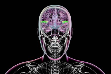 Enine şakak girdabı vurgulanmış insan beyni, önü yeşil, arkası sarı, üç boyutlu illüstrasyon. Bu bölgeler işitsel işleme ve dil kavrama ile ilgilidir..