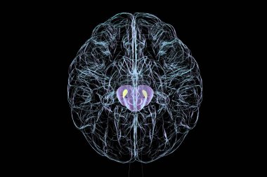 3D illustration of a human brain with atrophic substantia nigra (yellow) inside a transparent purple midbrain, depicting degeneration in Parkinson's disease. clipart