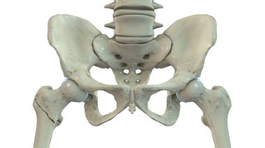 Uyluk kemiği kırığı, uyluk kemiğinin daha büyük ve daha küçük trochanters arasında bir kırık olduğunu gösteriyor..