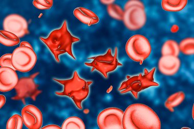 Akantolitler, dikene benzer projeksiyonları olan anormal kırmızı kan hücreleri, üç boyutlu çizimler. Ağır karaciğer hastalıklarında, E vitamini yetersizliğinde, splenektomide, kötü emilimde, hipotiroidizmde görülür.