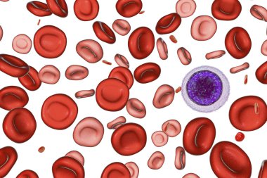 Anemi tedavisinde hemotransfüzyon, üç boyutlu illüstrasyon iki kırmızı kan hücresi popülasyonu, küçük hipokrom kırmızı kan hücreleri ve normal. Boyut karşılaştırması için küçük bir lenfosit çizilir
