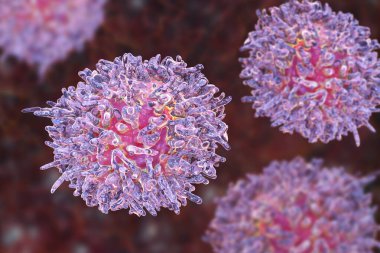 Kıllı hücre lösemisi, 3 boyutlu illüstrasyon. Anormal B lenfositleri birikmiş hematolojik, kronik lenfositik lösemi.