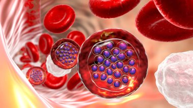 Sıtma bulaşmış kırmızı kan hücreleri. Sıtma paraziti Plasmodium Falciparum 'u, kırmızı kan hücrelerinin içinde, şizon aşamasında, tropikal sıtmanın nedensel faktörü olarak gösteriyor.