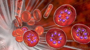 The malaria-infected red blood cell. 3D illustration showing parasite Plasmodium malariae in the schizont stage clipart