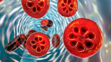 Sıtma bulaşmış kırmızı kan hücresi. Üç boyutlu illüstrasyon, şizontlarda plazma sıtması olduğunu gösteriyor.