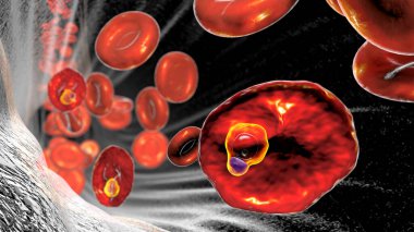 Sıtma bulaşmış kırmızı kan hücresi. Sıtma paraziti plazma ovale 'nin halka-formu trofozoit aşamasında olduğunu gösteriyor.