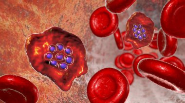 Sıtma bulaşmış kırmızı kan hücresi. Sıtma paraziti Plasmodium Ovale 'nin şizontluk evresinde 3 boyutlu bir resim.