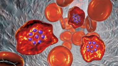Sıtma bulaşmış kırmızı kan hücresi. Sıtma paraziti Plasmodium Ovale 'nin şizontluk evresinde 3 boyutlu bir resim.