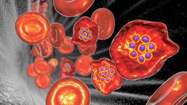 Sıtma bulaşmış kırmızı kan hücresi. Sıtma paraziti Plasmodium Ovale 'nin şizontluk evresinde 3 boyutlu bir resim.