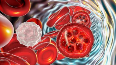 Malaria infection, 3D illustration. Plasmodium parasites inside red blood cells in the stage of schizont clipart