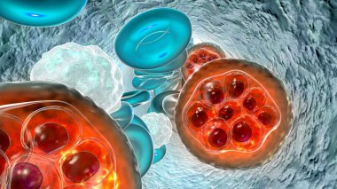 Sıtma enfeksiyonu, 3 boyutlu illüstrasyon. Şizontluk evresinde alyuvar içindeki plazma parazitleri.