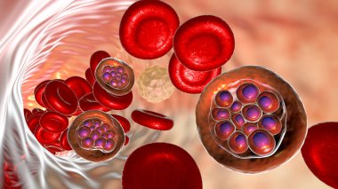 Sıtma bulaşmış kırmızı kan hücreleri. Üç boyutlu illüstrasyon, şizon evresinde kırmızı kan hücrelerinde sıtma paraziti plasmodyum vivax 'ı gösteriyor.