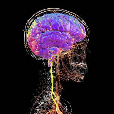 Vertebral arterlerin (sarı) 3 boyutlu çizimi, hayati fonksiyonlar ve koordinasyon için gerekli olan beyin sapı, beyincik ve arka beyin bölgelerine kan sağlamaktadır..