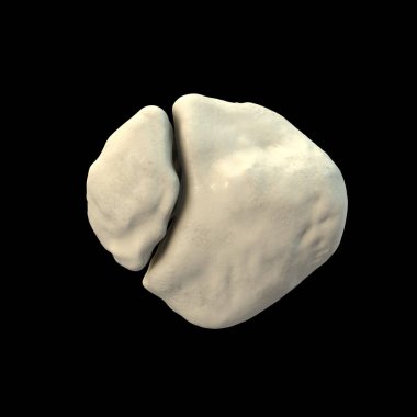 Çift taraflı dizkapağı, üç boyutlu illüstrasyon. Diz kapağının erimemiş bir aksesuar ossifikasyon merkezi var. Genellikle süper olateral. Tamamen kaynaşmak yerine iki ayrı kemik parçası olarak kalır..