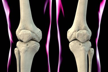 Diz kemiği anatomisi, uyluk kemiği, kaval kemiği, kamış kemiği ve diz kapağı kemiğini gösteren 3 boyutlu illüstrasyon..