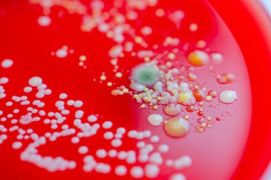 Bakteriyel ve küf mantarı kolonileri kan koyunları üzerinde kapalı havadan yetişiyor, mikrobik çeşitlilik ve hava kirliliği gösteren fotoğraflar sergiliyor..