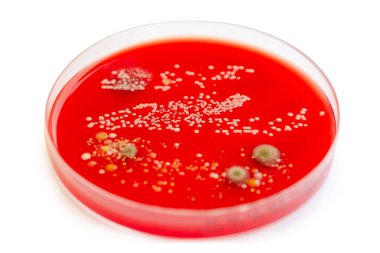 Bakteriyel ve küf mantarı kolonileri kan koyunları üzerinde kapalı havadan yetişiyor, mikrobik çeşitlilik ve hava kirliliği gösteren fotoğraflar sergiliyor..