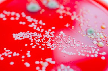 Bakteriyel ve küf mantarı kolonileri kan koyunları üzerinde kapalı havadan yetişiyor, mikrobik çeşitlilik ve hava kirliliği gösteren fotoğraflar sergiliyor..