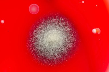 Bakteriyel ve küf mantarı kolonileri kan koyunları üzerinde kapalı havadan yetişiyor, mikrobik çeşitlilik ve hava kirliliği gösteren fotoğraflar sergiliyor..