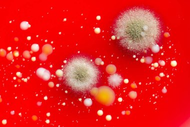 Bakteriyel ve küf mantarı kolonileri kan koyunları üzerinde kapalı havadan yetişiyor, mikrobik çeşitlilik ve hava kirliliği gösteren fotoğraflar sergiliyor..