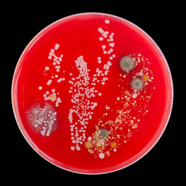 Bakteriyel ve küf mantarı kolonileri kan koyunları üzerinde kapalı havadan yetişiyor, mikrobik çeşitlilik ve hava kirliliği gösteren fotoğraflar sergiliyor..