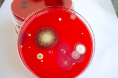 Bakteriyel ve küf mantarı kolonileri kan koyunları üzerinde kapalı havadan yetişiyor, mikrobik çeşitlilik ve hava kirliliği gösteren fotoğraflar sergiliyor..