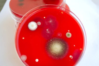 Bakteriyel ve küf mantarı kolonileri kan koyunları üzerinde kapalı havadan yetişiyor, mikrobik çeşitlilik ve hava kirliliği gösteren fotoğraflar sergiliyor..