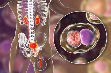 İnsanda klamidyoz enfeksiyonu, 3 boyutlu illüstrasyon Chlamydia trachomatis bakterisinin üretral epitel hücreleri enfekte ettiğini gösteriyor.