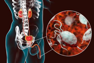 İnsanda trikomonez enfeksiyonu, üretrit iltihabına neden olan trikomonik vajinaya yakın çekim ve üretrit erkek anatomisini gösteren 3 boyutlu illüstrasyon.