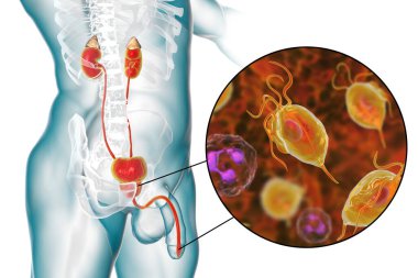 İnsanda trikomonez enfeksiyonu, üretrit iltihabına neden olan trikomonik vajinaya yakın çekim ve üretrit erkek anatomisini gösteren 3 boyutlu illüstrasyon.
