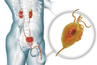 İnsanda trikomonez enfeksiyonu, üretrit iltihabına neden olan trikomonik vajinaya yakın çekim ve üretrit erkek anatomisini gösteren 3 boyutlu illüstrasyon.