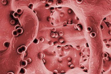 Kemik dokusunda küresel bakteri. Kemik iltihabı, 3 boyutlu illüstrasyon