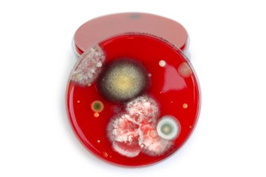 Bakteriyel ve küf mantarı kolonileri kan koyunları üzerinde kapalı havadan yetişiyor, mikrobik çeşitlilik ve hava kirliliği gösteren fotoğraflar sergiliyor..