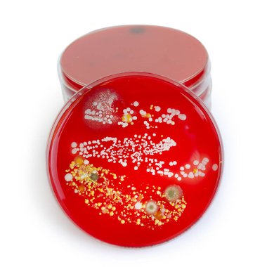 Bakteriyel ve küf mantarı kolonileri kan koyunları üzerinde kapalı havadan yetişiyor, mikrobik çeşitlilik ve hava kirliliği gösteren fotoğraflar sergiliyor..