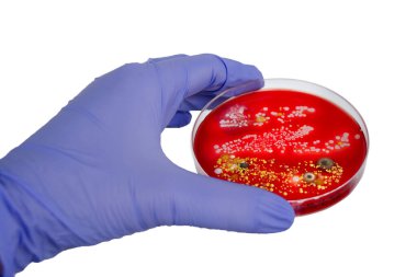 Bakteriyel ve küf mantarı kolonileri kanlı koyun ağılında deri yüzeyinden büyümüş, mikrobik çeşitlilik ve deri kirliliği gösteren fotoğraflar sergiliyorlar..