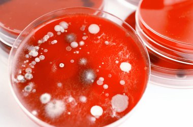 Bakteriyel ve küf mantarı kolonileri kan koyunları üzerinde kapalı havadan yetişiyor, mikrobik çeşitlilik ve hava kirliliği gösteren fotoğraflar sergiliyor..