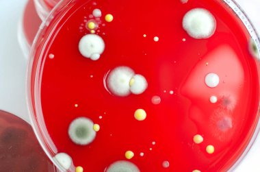 Bakteriyel ve küf mantarı kolonileri kan koyunları üzerinde kapalı havadan yetişiyor, mikrobik çeşitlilik ve hava kirliliği gösteren fotoğraflar sergiliyor..