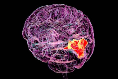 Cuneus gyrus insan beyninde vurgulanmış, görsel işlemden, uzamsal yönelimden ve görsel bozukluklardan ve bilişsel bozukluklardan sorumlu, 3 boyutlu resimleme.