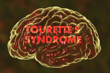 Tourette sendromu, tıbbi konsept, 3 boyutlu illüstrasyon. Sinir hastalıkları spektrumu ile karakterize edilen bir nöropsikiyatrik bozukluk.