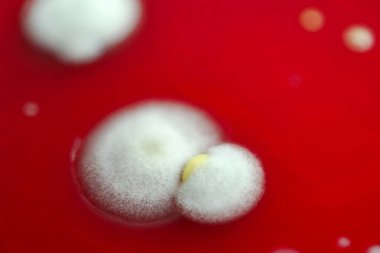 Küf mantarı kolonileri, kapalı alandaki havadan yetiştirilmiş kan koyunları üzerinde büyümüş, mikrobik çeşitlilik ve hava kirliliği gösteren fotoğraflar sergiliyor..