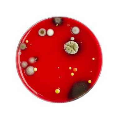 Bakteriyel ve küf mantarı kolonileri kan koyunları üzerinde kapalı havadan yetişiyor, mikrobik çeşitlilik ve hava kirliliği gösteren fotoğraflar sergiliyor..