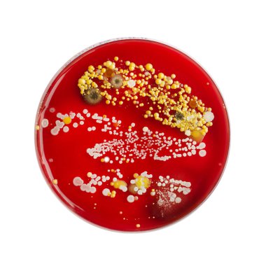 Bakteriyel ve küf mantarı kolonileri kanlı koyun ağılında deri yüzeyinden büyümüş, mikrobik çeşitlilik ve deri kirliliği gösteren fotoğraflar sergiliyorlar..