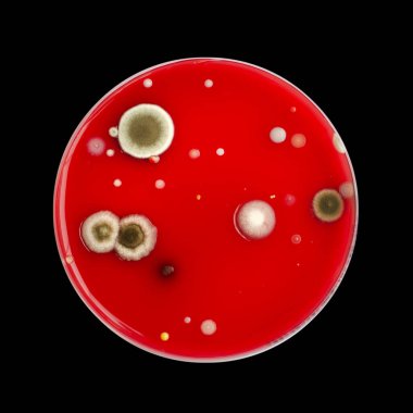 Bakteriyel ve küf mantarı kolonileri kan koyunları üzerinde kapalı havadan yetişiyor, mikrobik çeşitlilik ve hava kirliliği gösteren fotoğraflar sergiliyor..