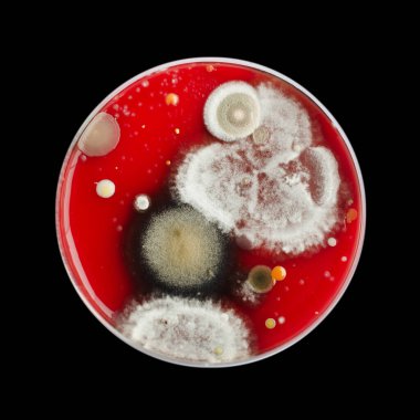 Bakteriyel ve küf mantarı kolonileri kan koyunları üzerinde kapalı havadan yetişiyor, mikrobik çeşitlilik ve hava kirliliği gösteren fotoğraflar sergiliyor..