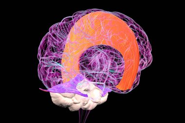 Vurgulanmış falx serebri (portakal) ve tentoryum serebenti (mor) olan insan beyni, beynin koruyucu zarlarını gösteren 3 boyutlu resimleme.